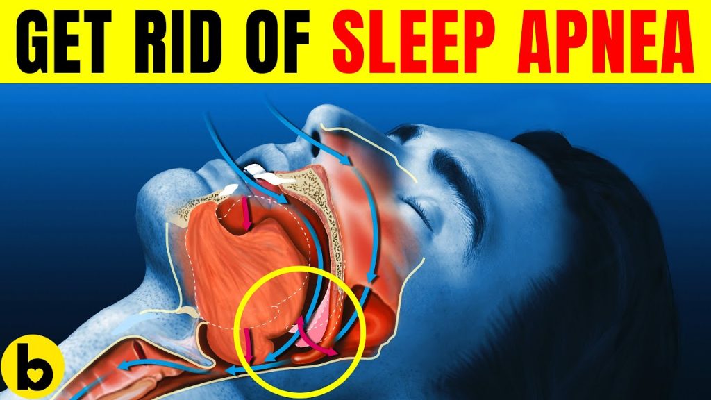 Advice On How To Get Rid Of Sleep Apnea